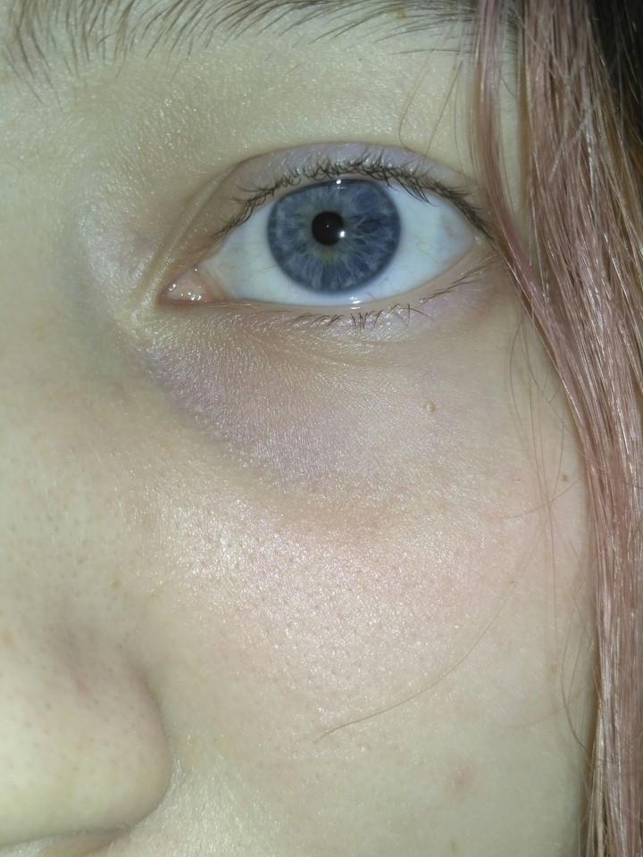 eye