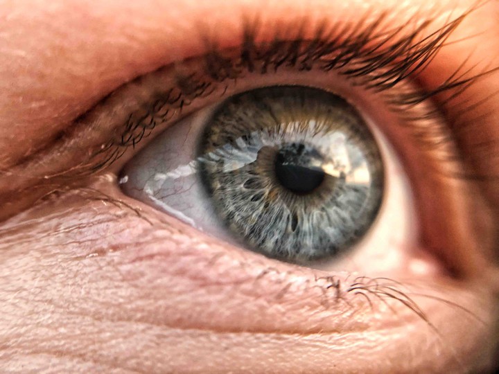 eye