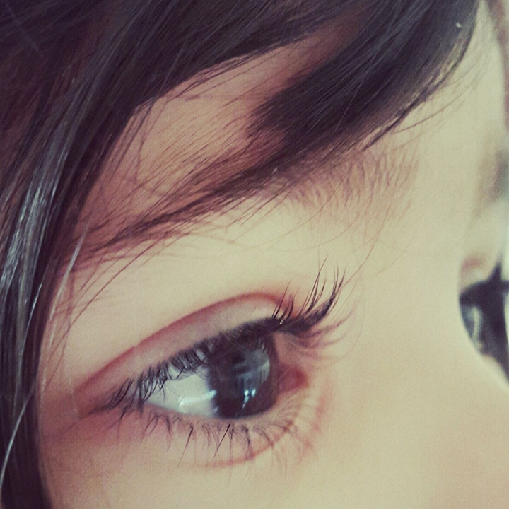 eye