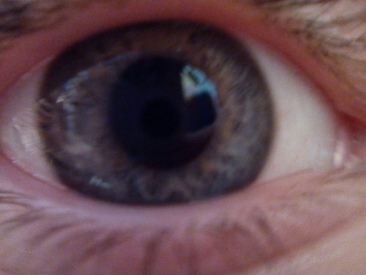 eye