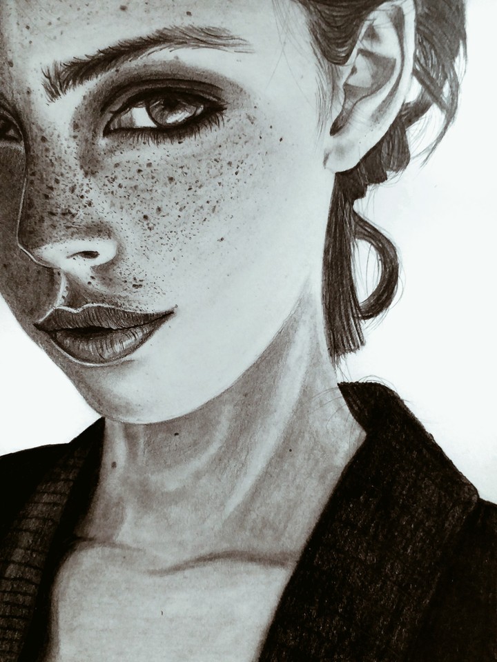 Freckles