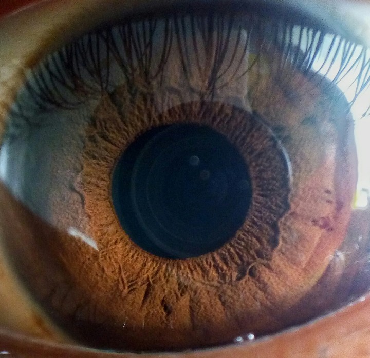 eye