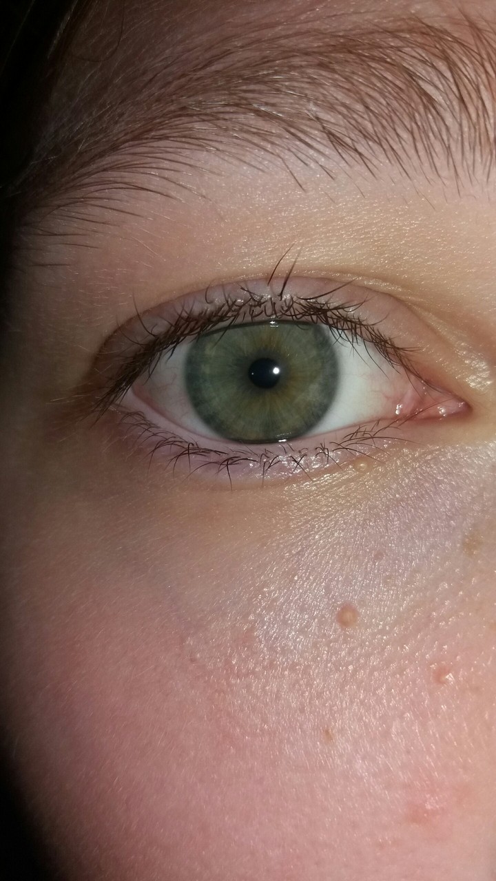 My eye
