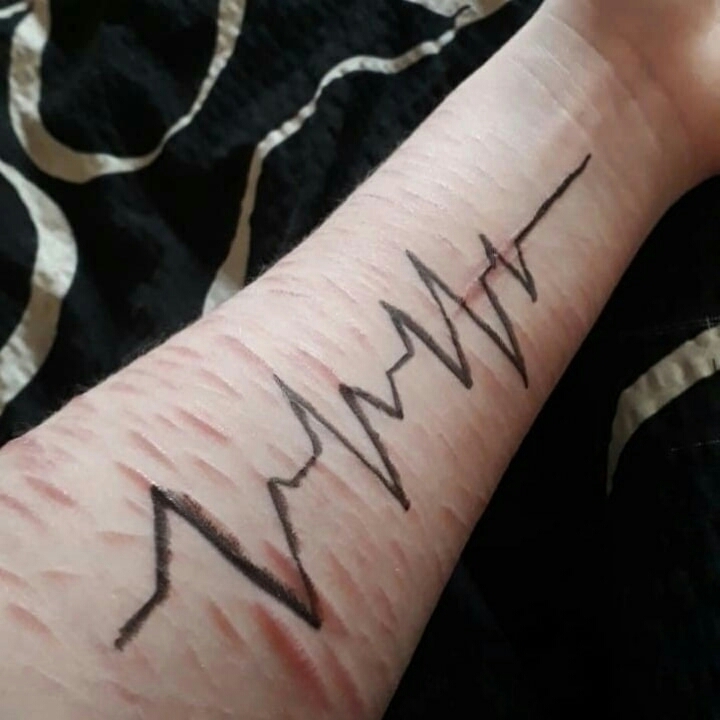 Hand