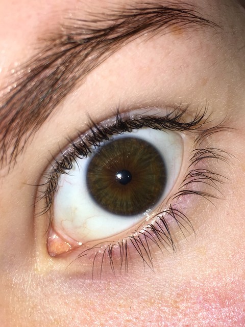 eye