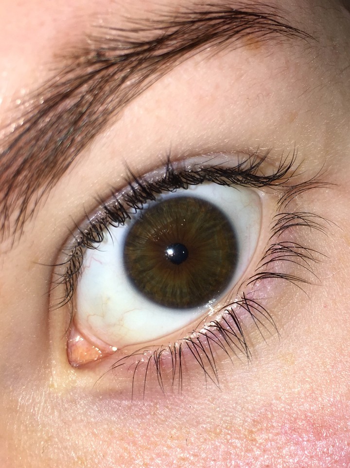 eye