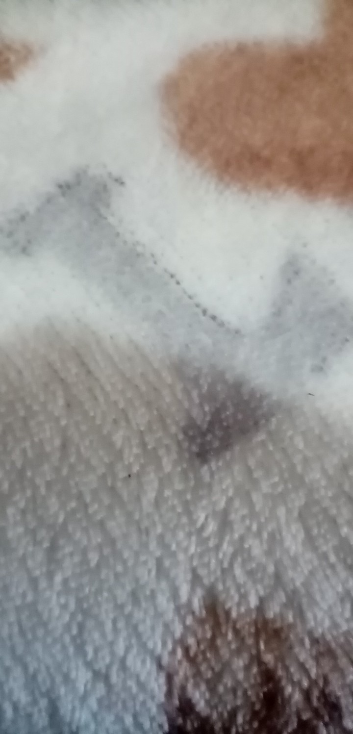 113