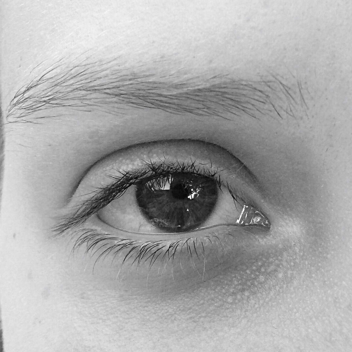 Eye