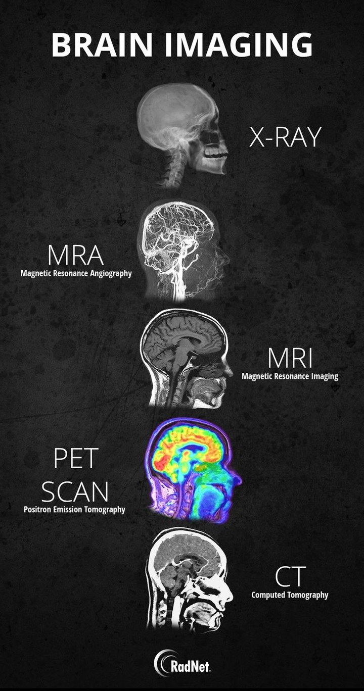 image in medicine