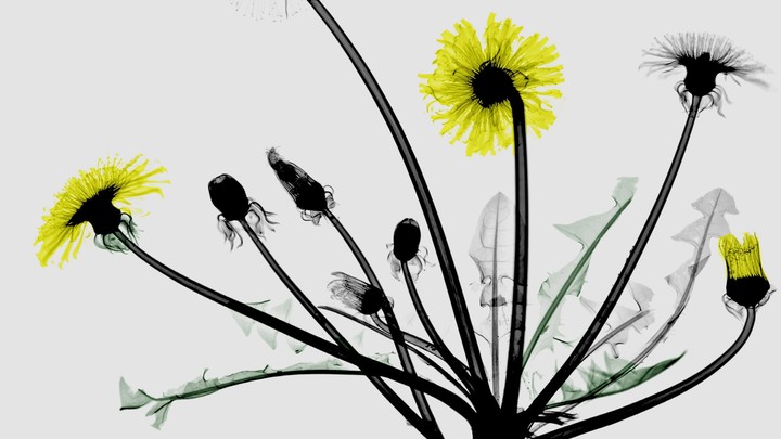 Colored X-ray Dandelion.