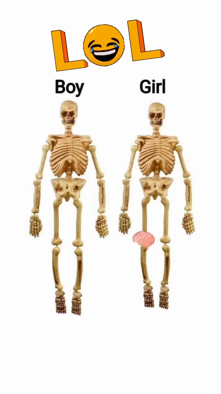 #lol