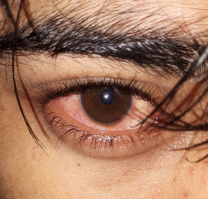 Red Eyes