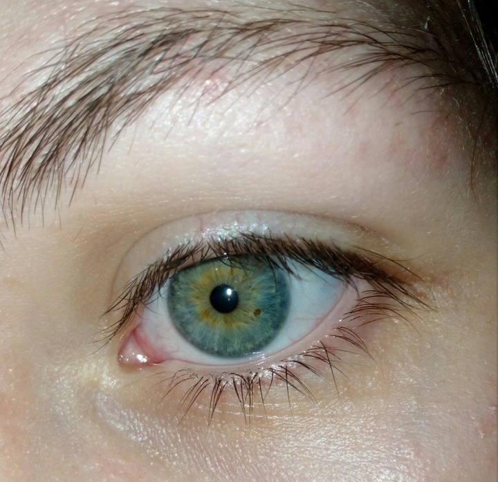 my eye