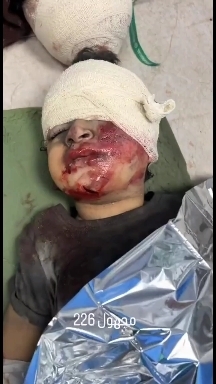 America and Israel kills children