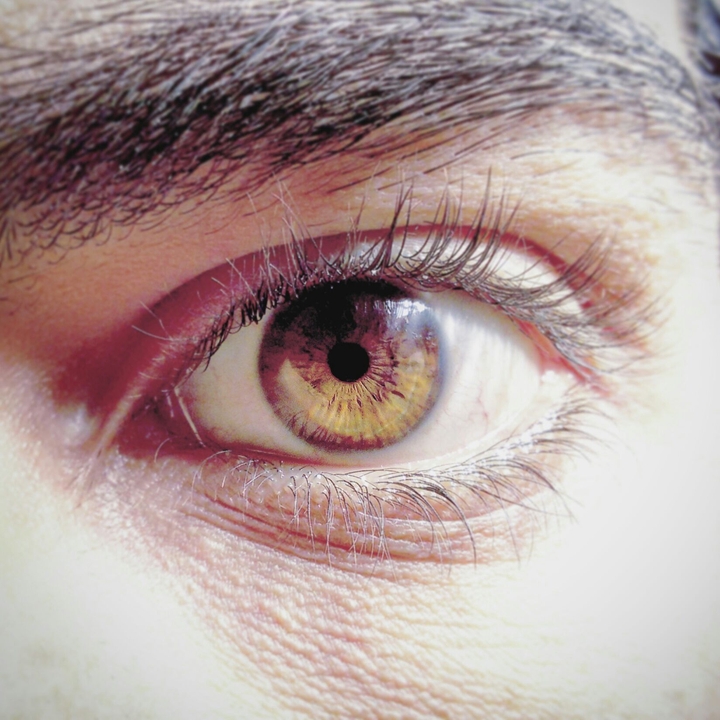 Eye