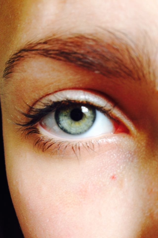 eye