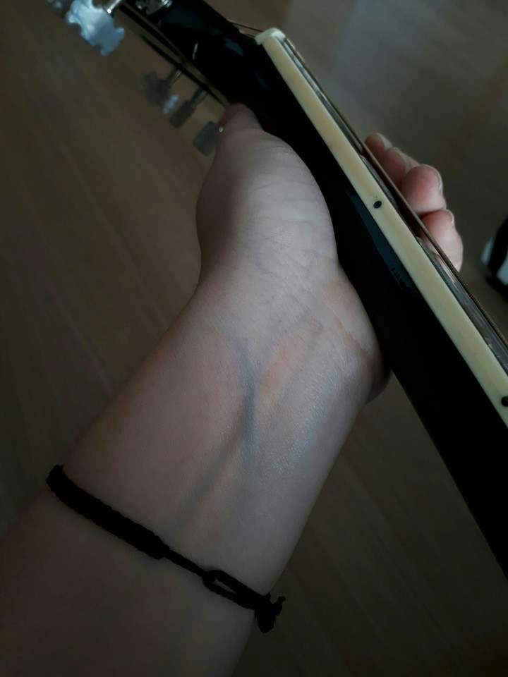 veins