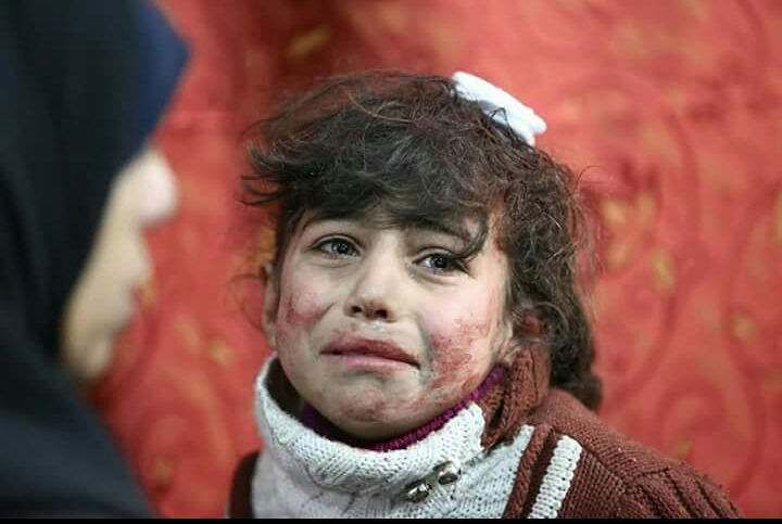 Syria war innocent victim
