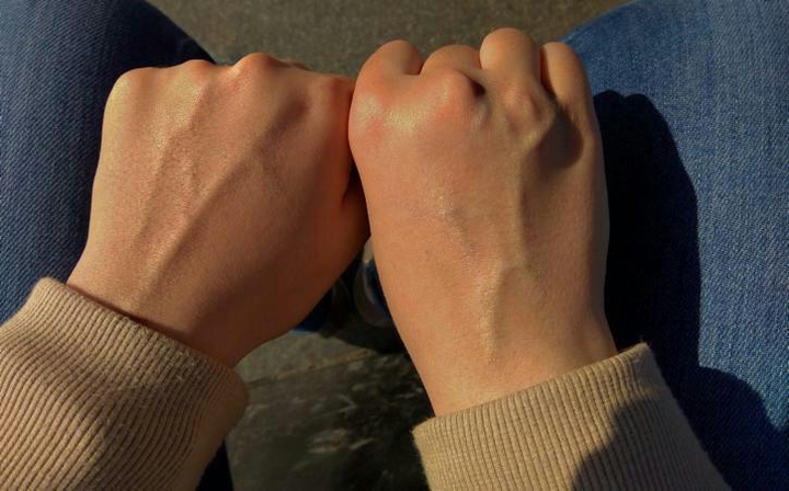 veins