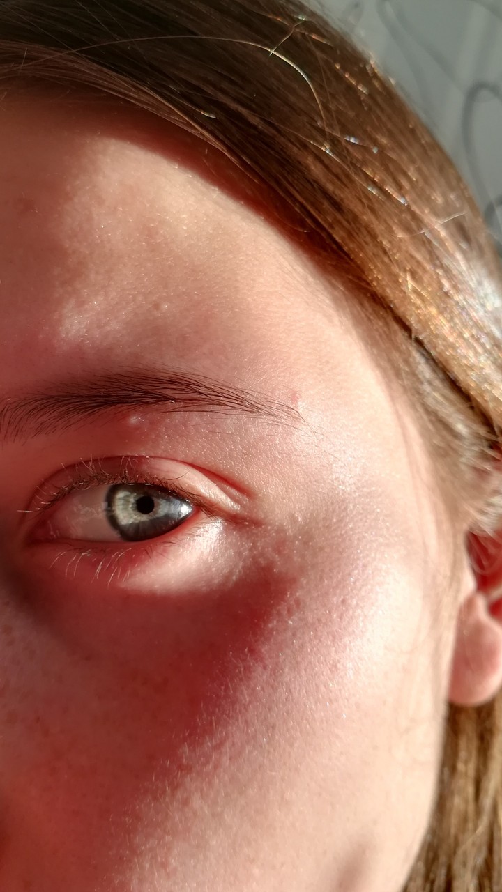 eye