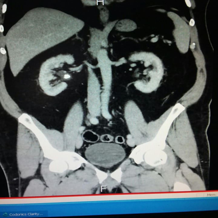 xray