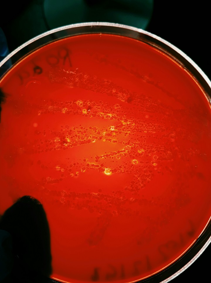#bacteria#colonies#betahemolysia #bloodagar #plate