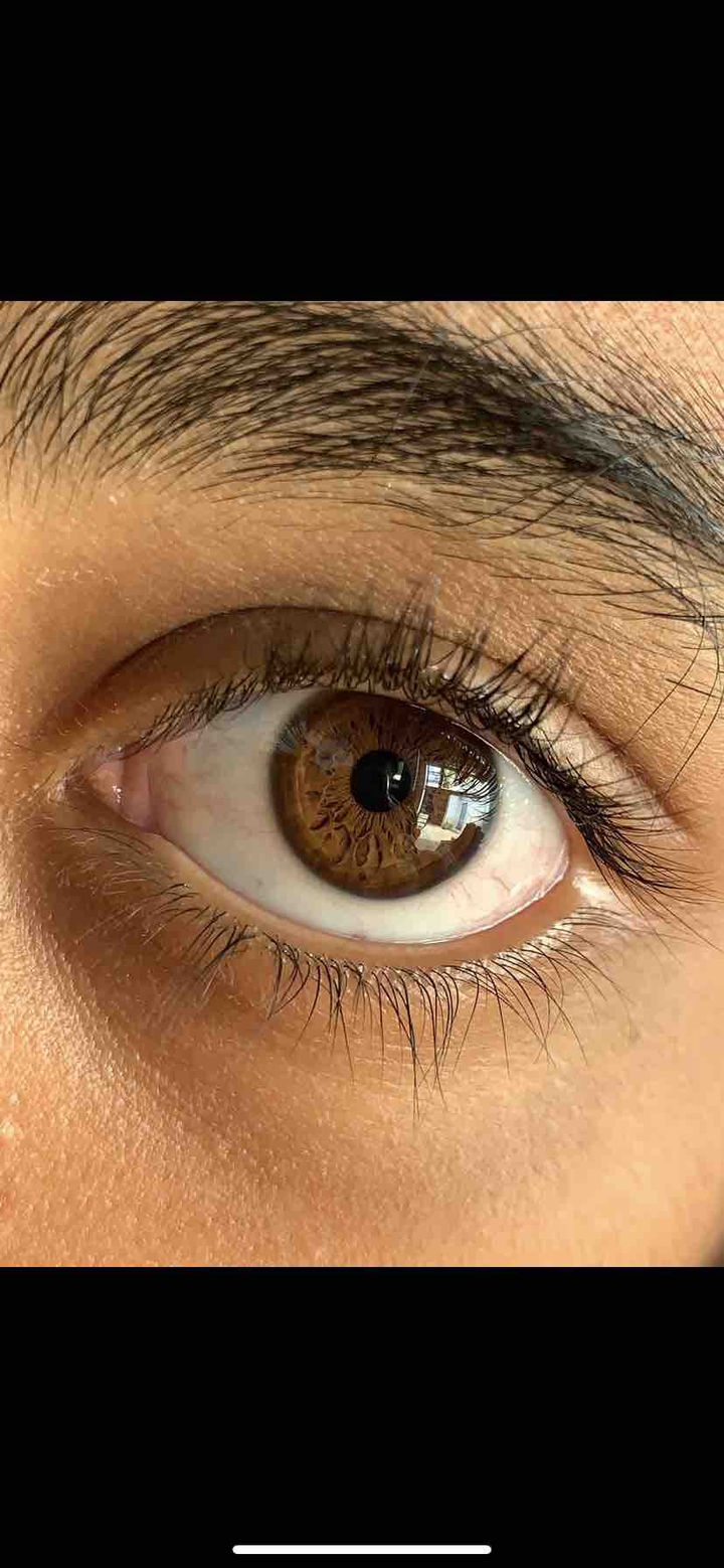 eye