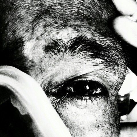 the eye