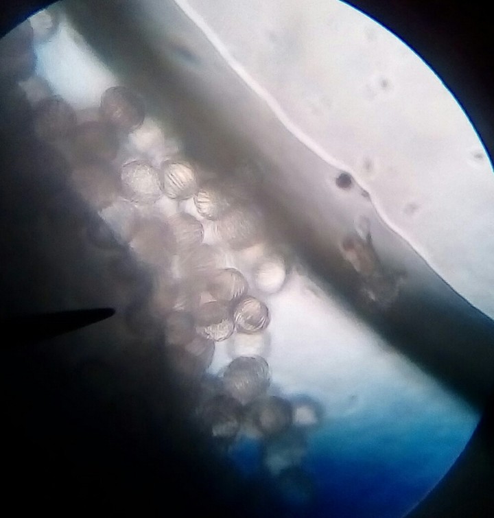 pollen