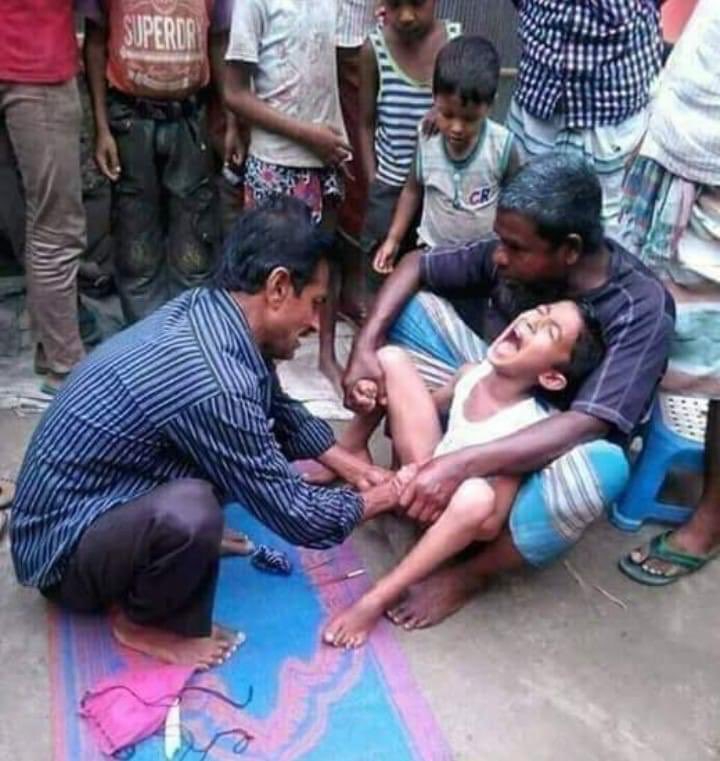 circumcission - brutal process to become Muslim !!