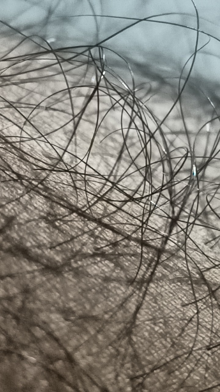 hair