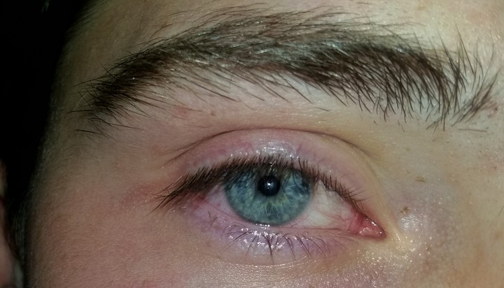 blue eyes