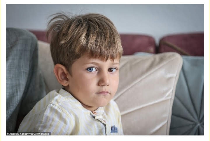boy with different colours of eye