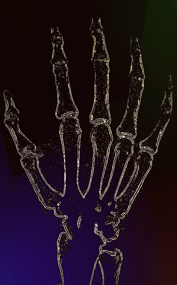 bones