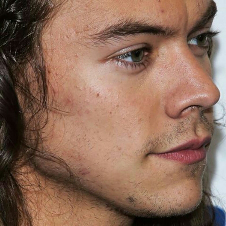 Harry Styles