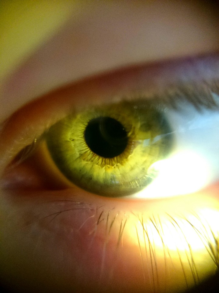 Eye