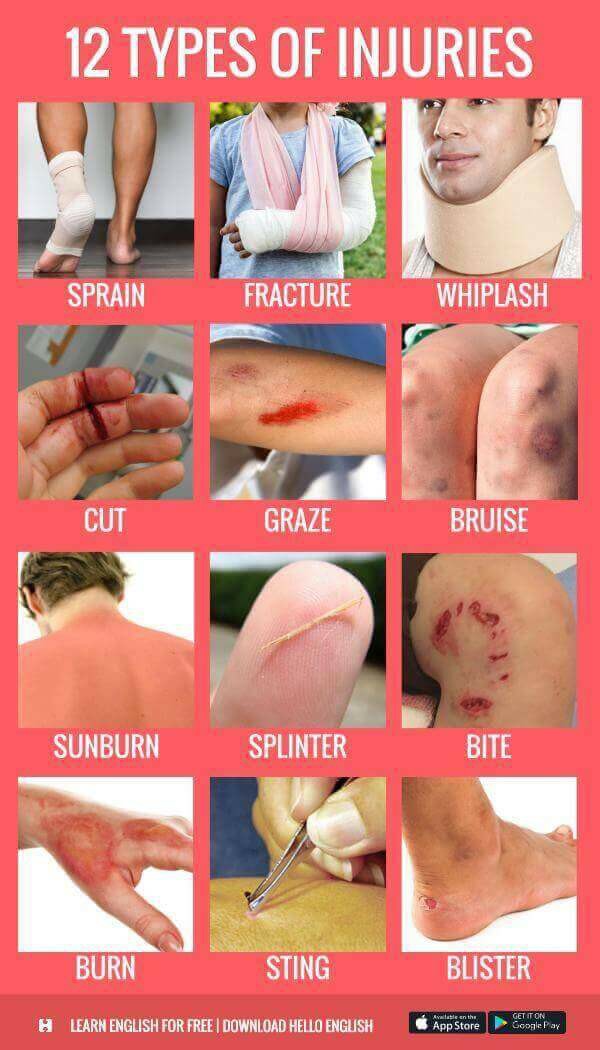the types of injuries