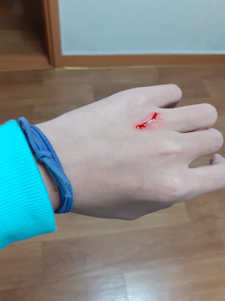 痛
