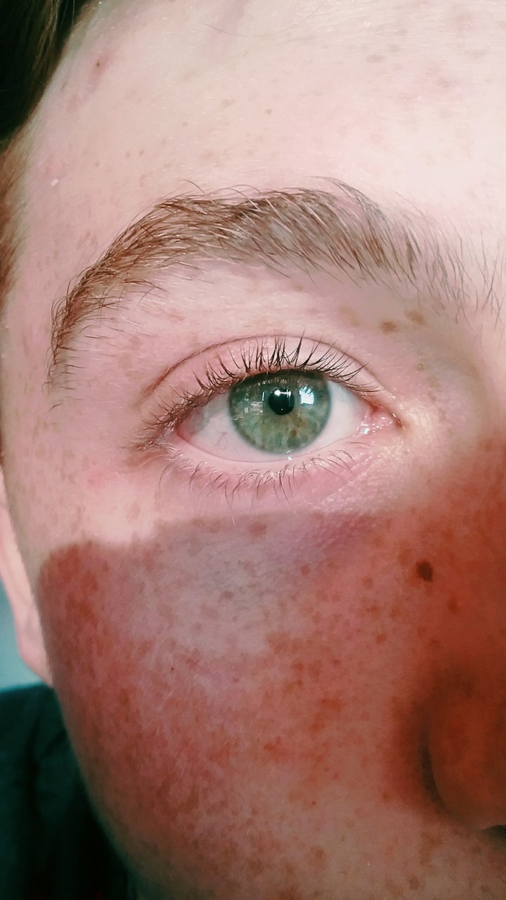 green eyes