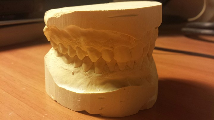 teeth
