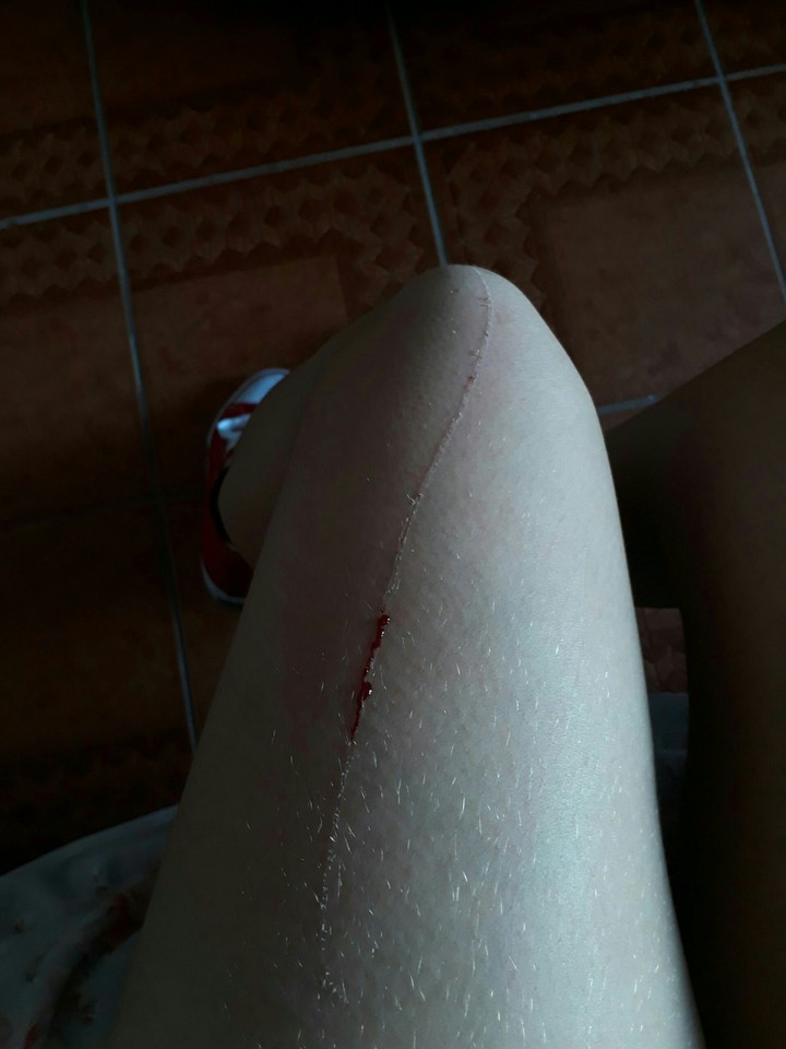 scratch
