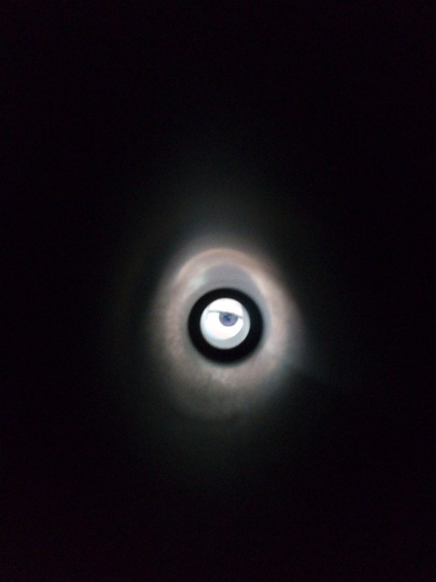 Eye