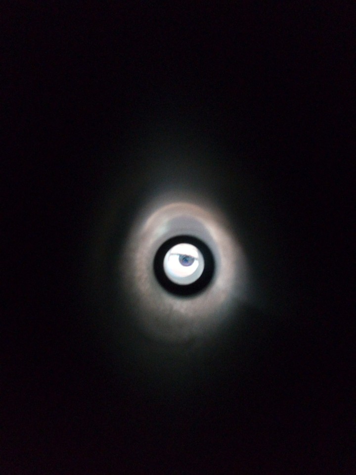 Eye