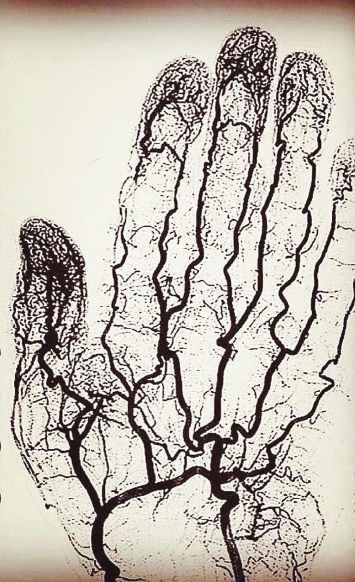 vascularisation de la main