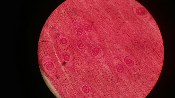 parasite