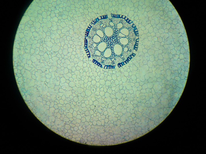 Iris root, Microscopic photography