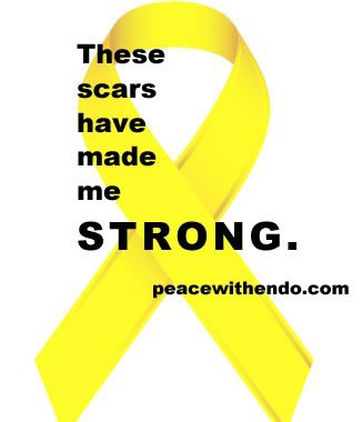 endometriosis (My story)