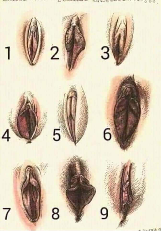 ????