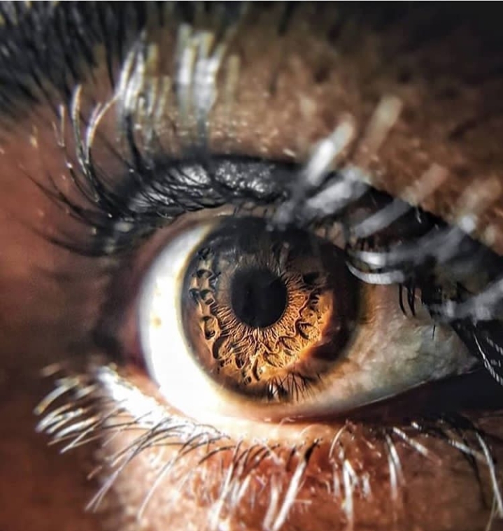 eye