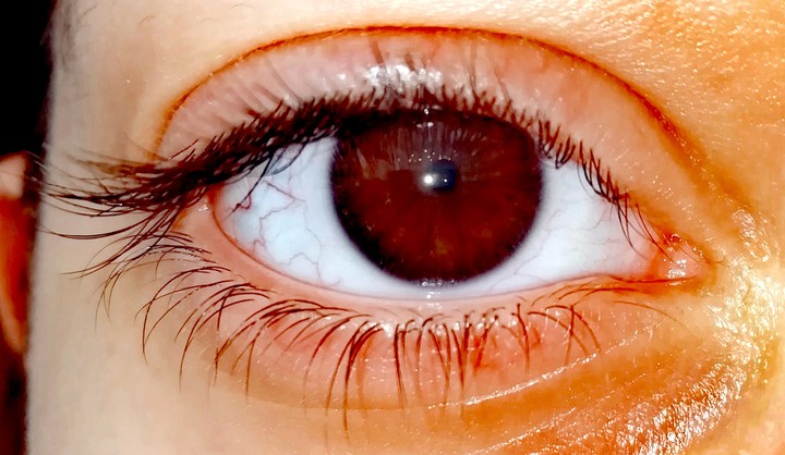 eye